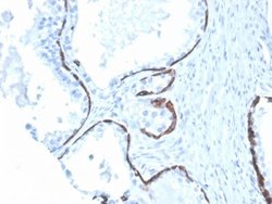 Cytokeratin 5/6 Antibody (KRT5.6/4866) - Azide and BSA Free, Novus Biologicals 100 &mu;g | Buy Online | Novus Biologicals | Fisher Scientific